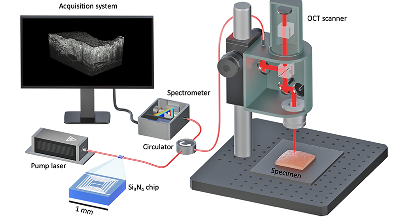 Millimeter-scale chip–based supercontinuum generation for optical coherence tomography